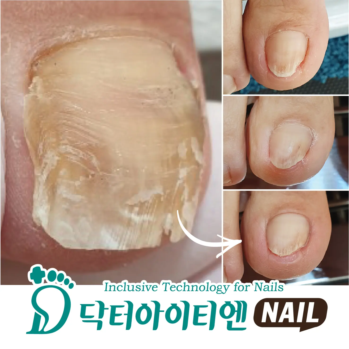 이미지 6