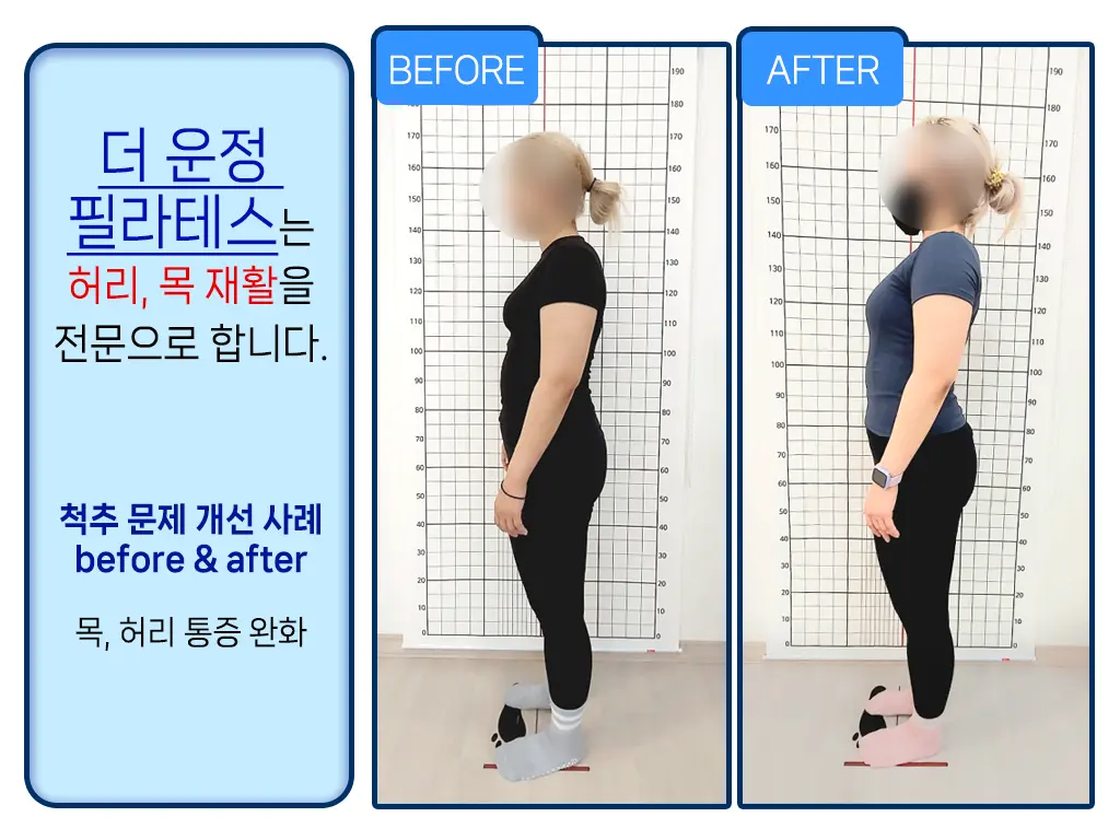 이미지 6