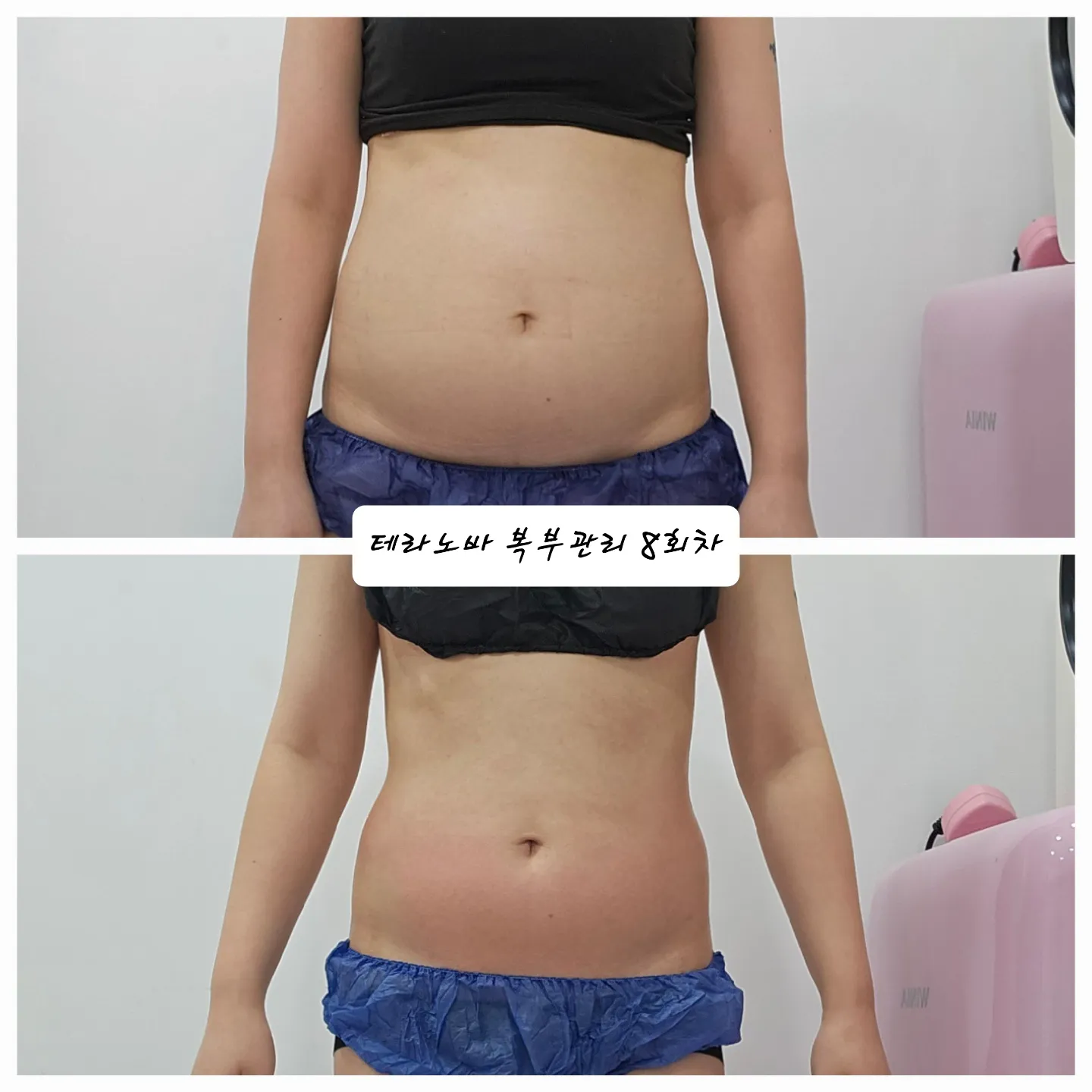 이미지 3