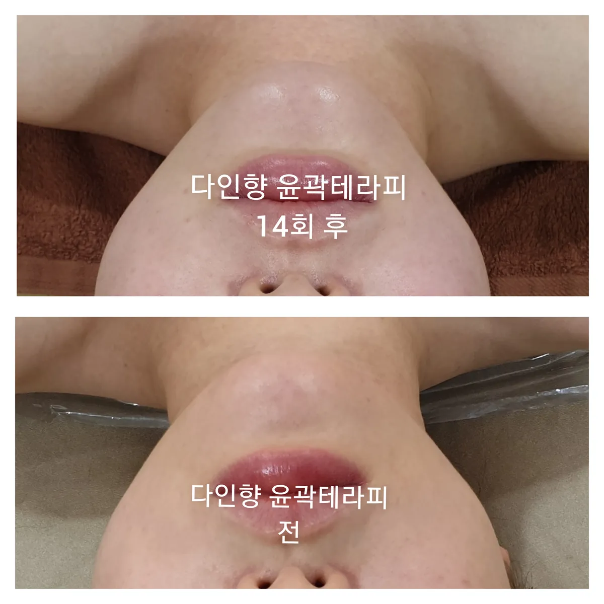이미지 7