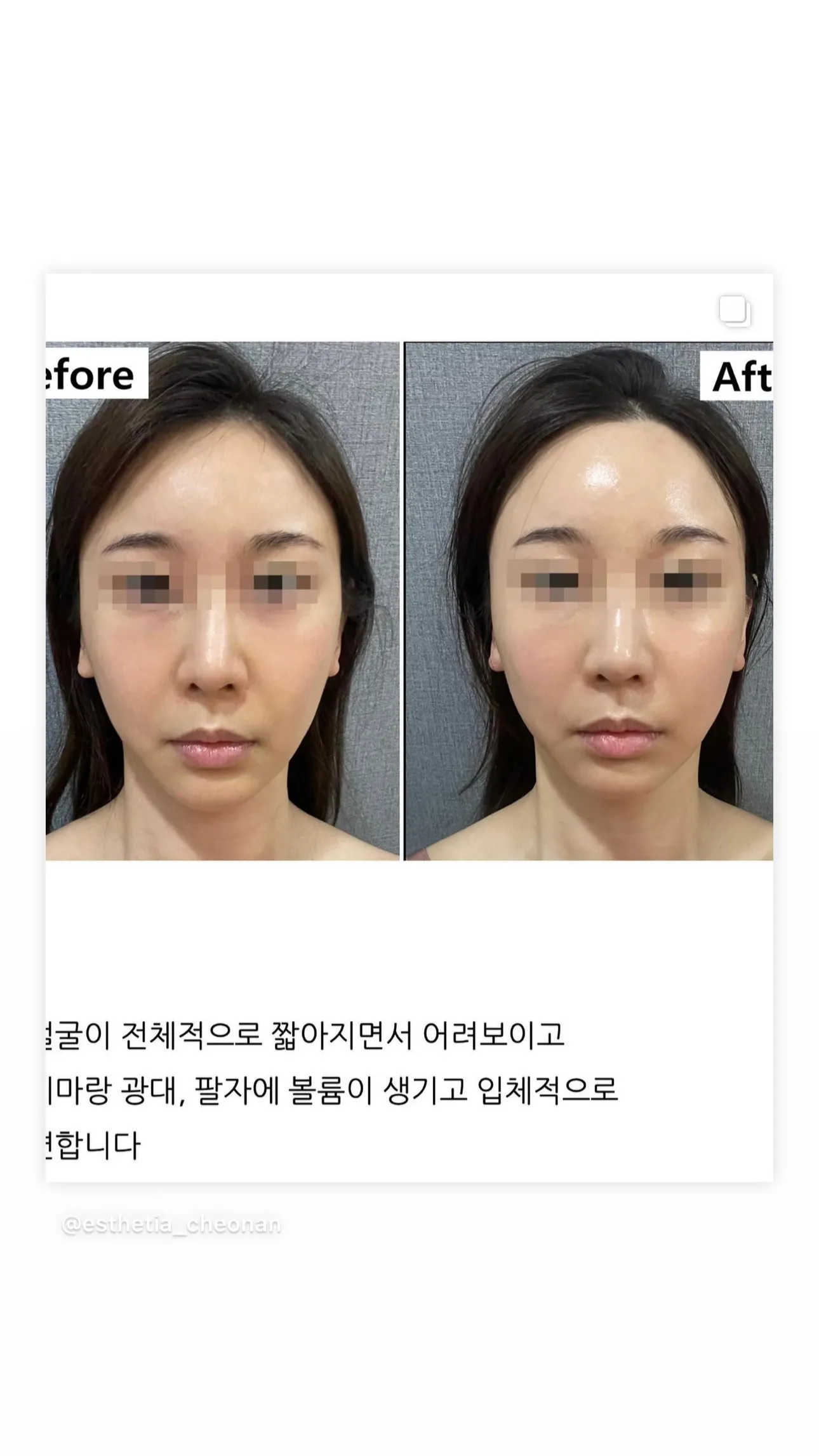 축소경락 작은얼굴 경락관리 / 권선희 - 숨고, 숨은고수 축소경락 작은얼굴 경락관리