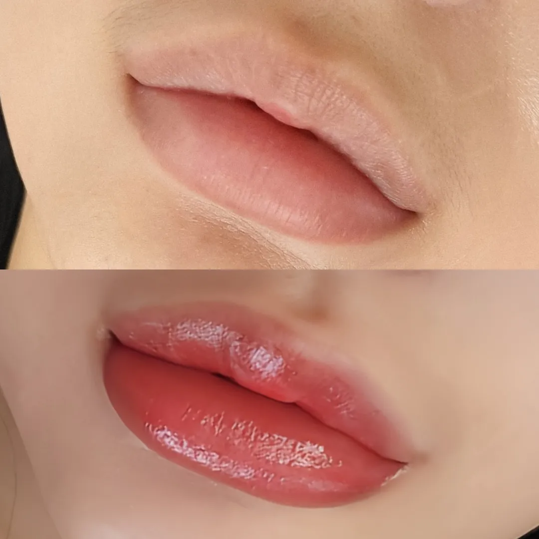이미지 7