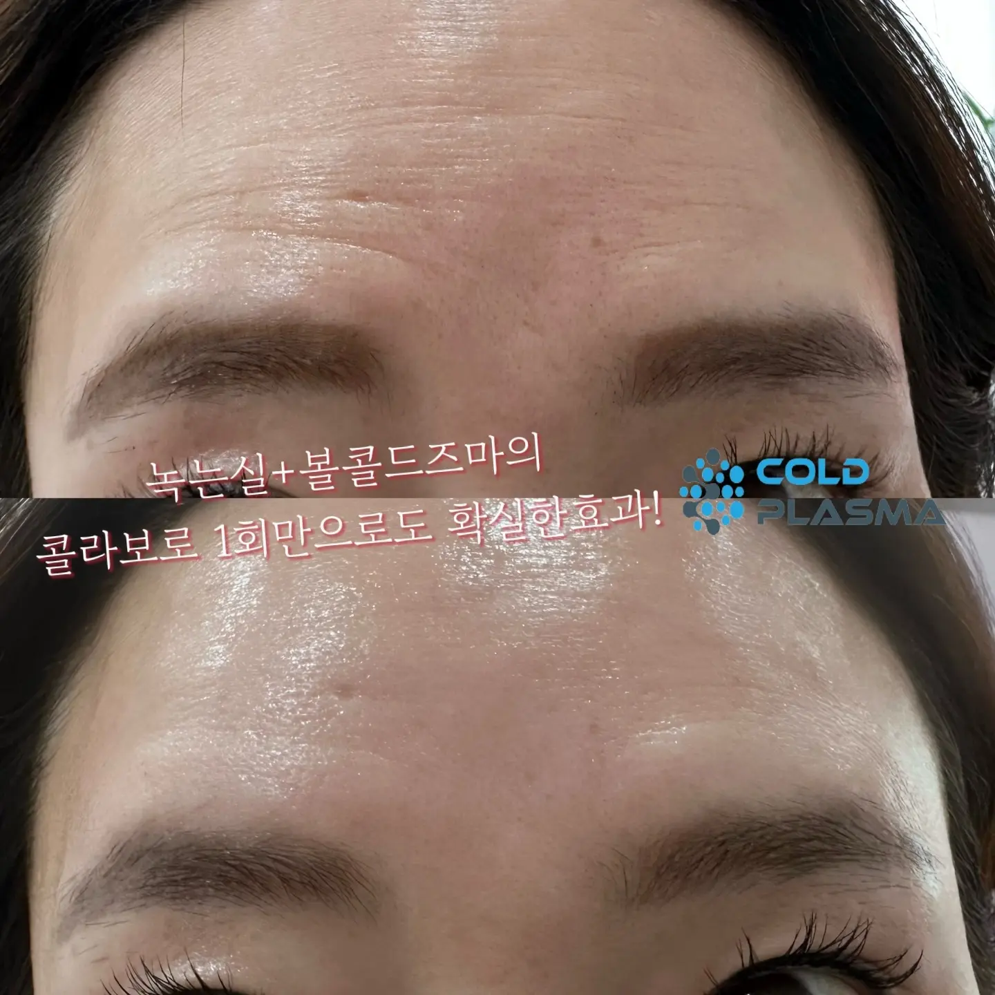 이미지 7