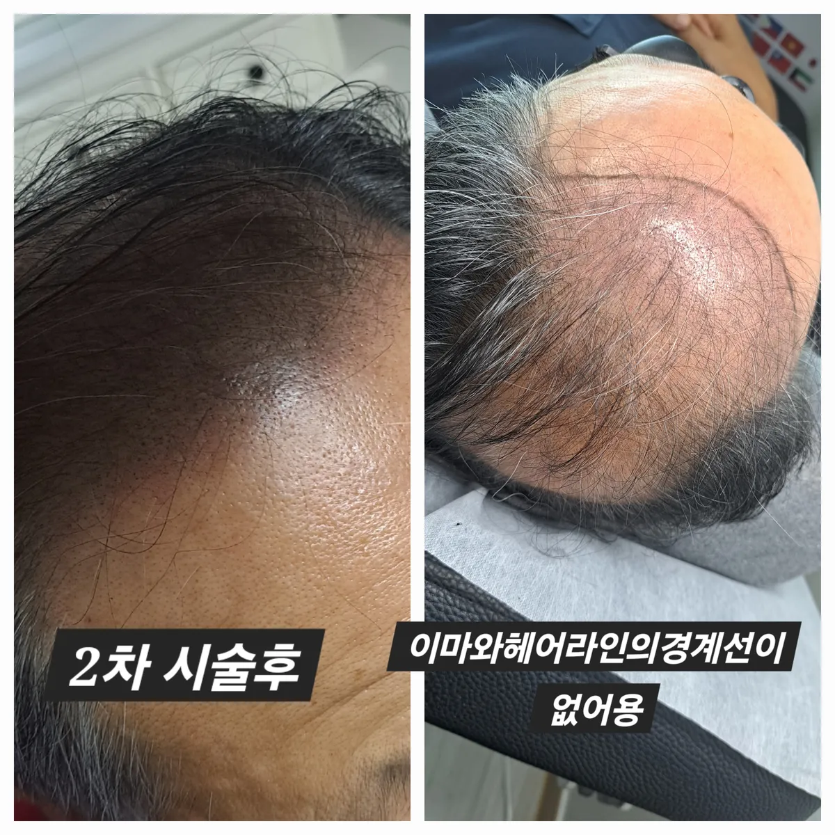 이미지 8