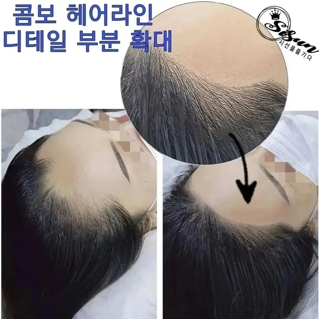 이미지 4