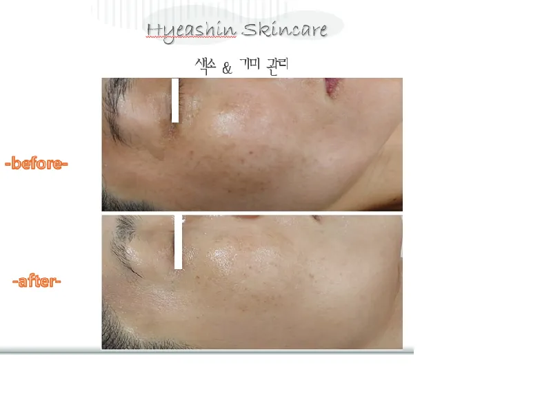 이미지 8