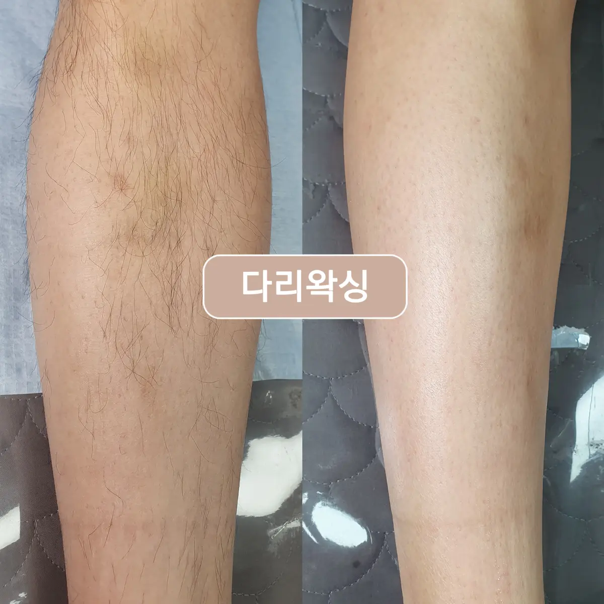 이미지 2
