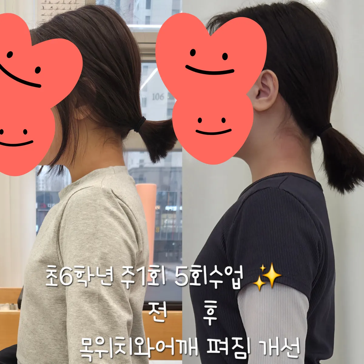 이미지 2