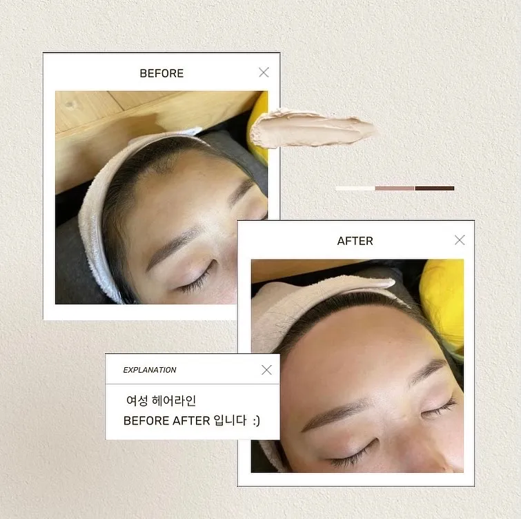 이미지 7
