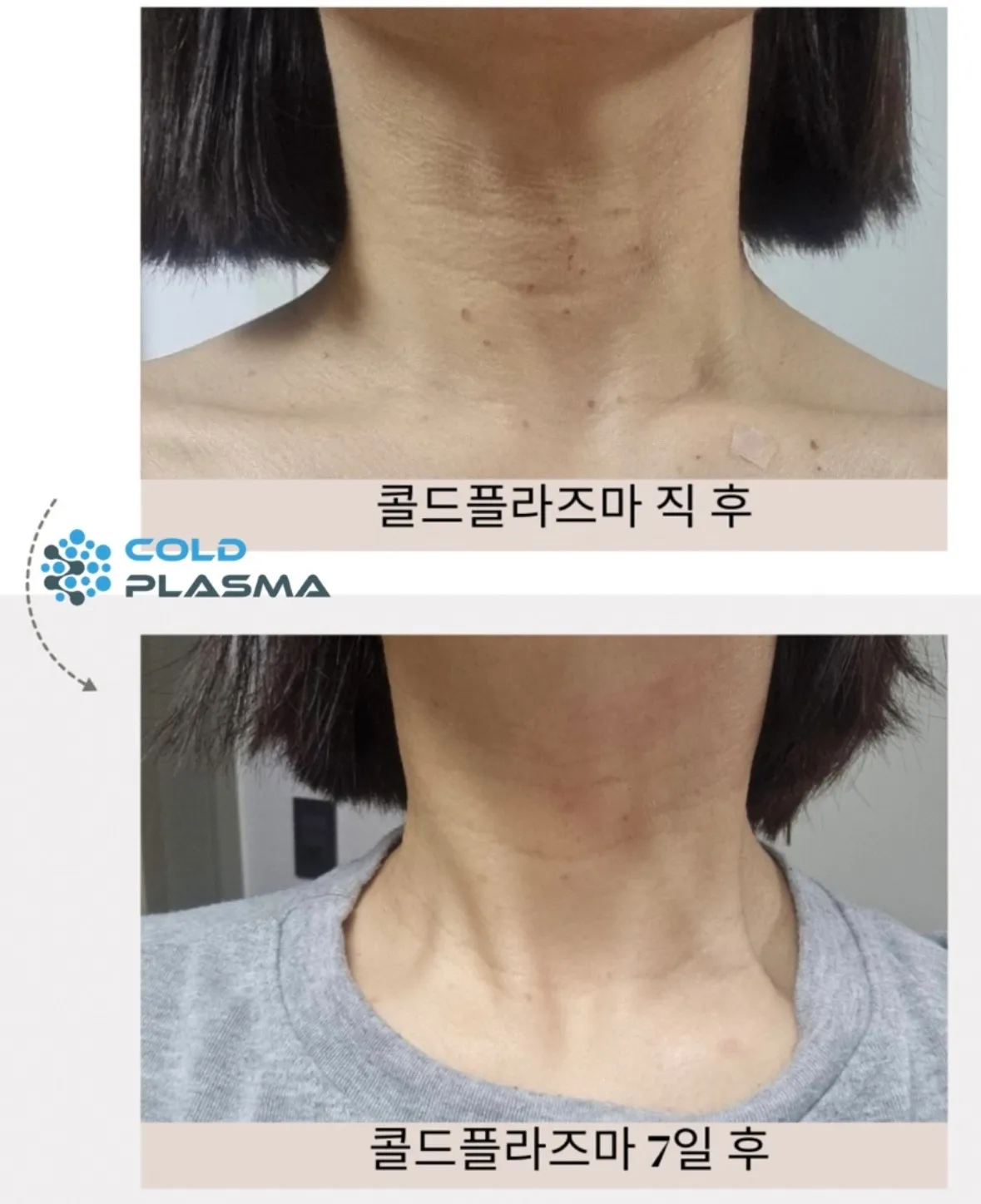 이미지 5