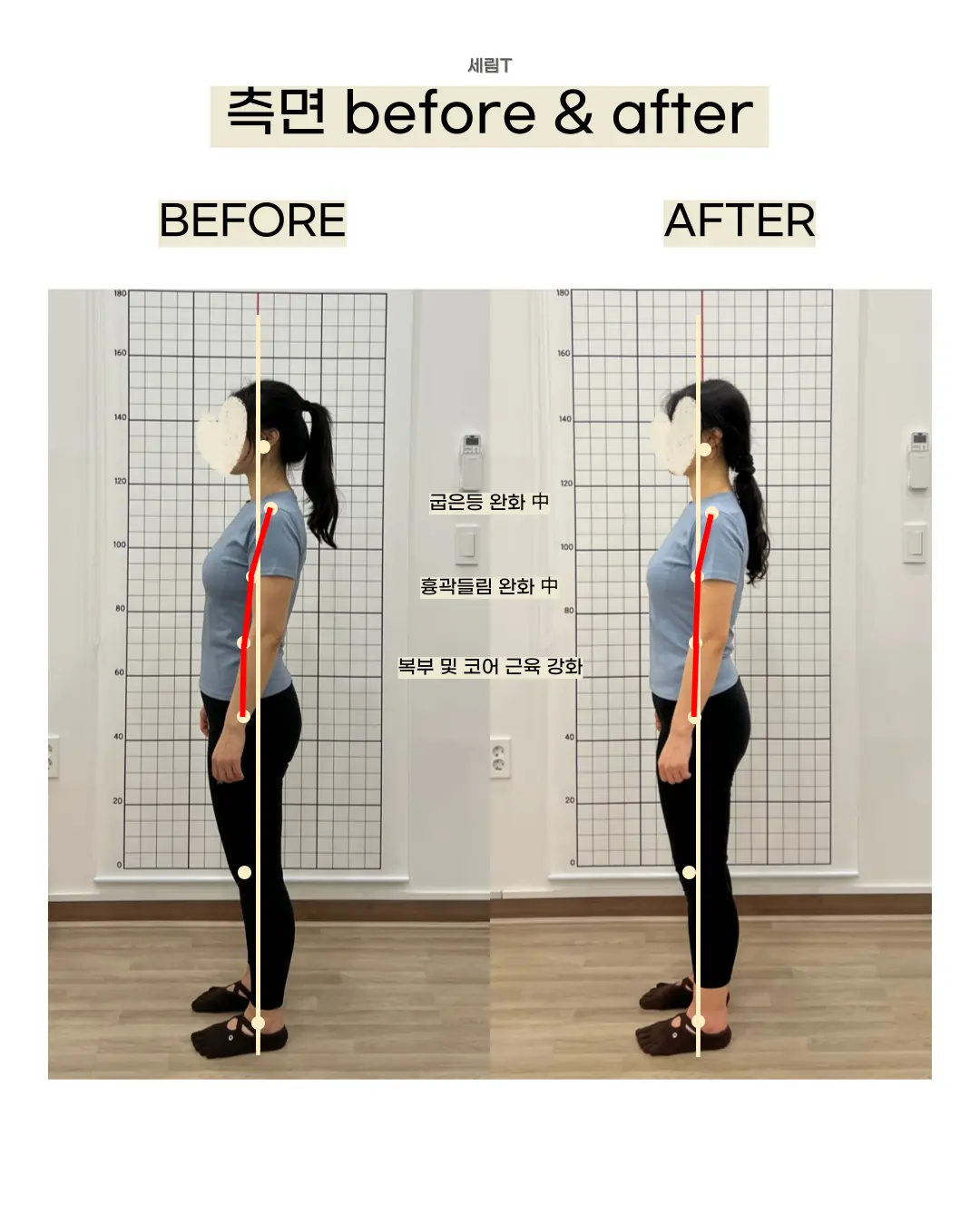 이미지 10