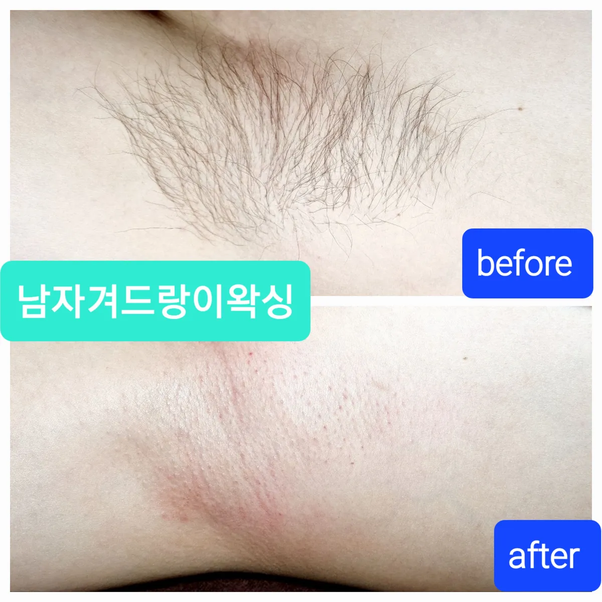 이미지 4