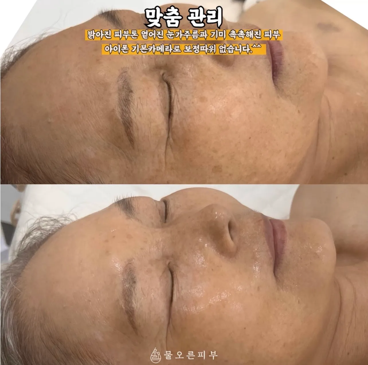 이미지 11