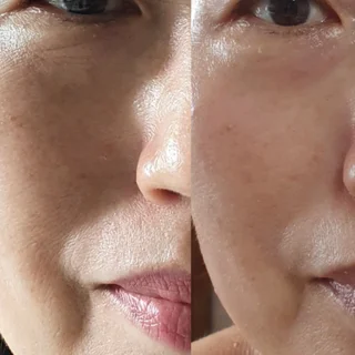 주름 탄력관리