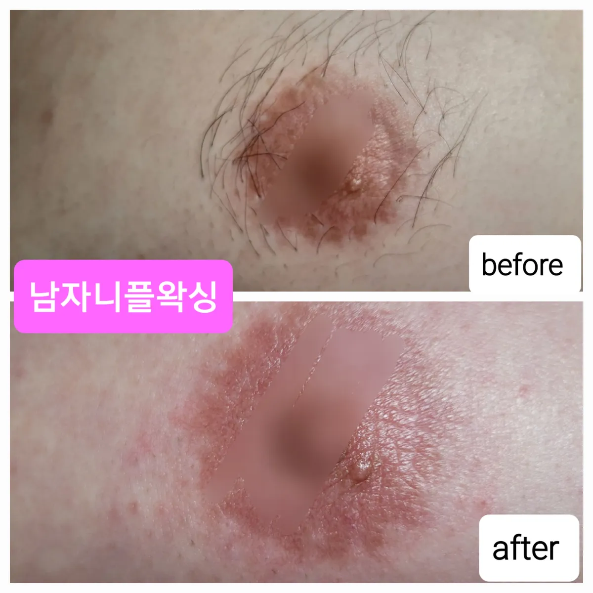 이미지 6