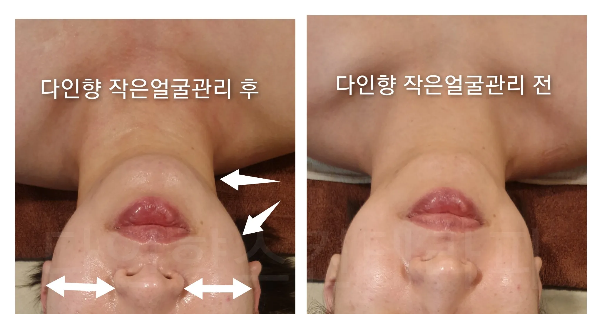 이미지 6