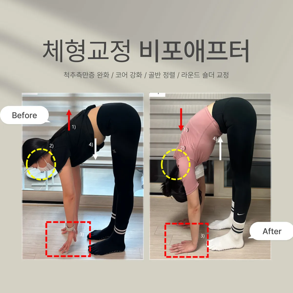 이미지 6