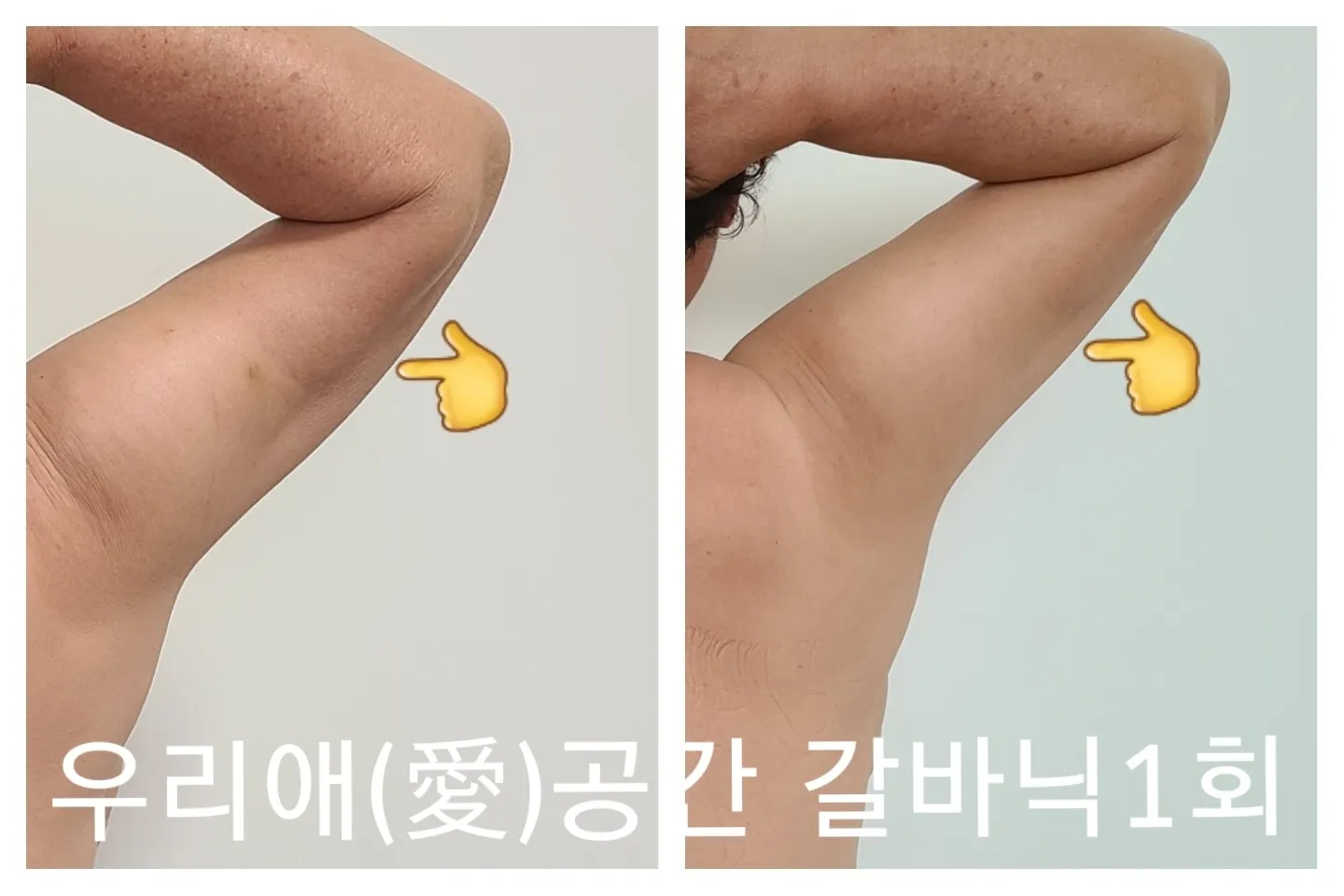 이미지 9