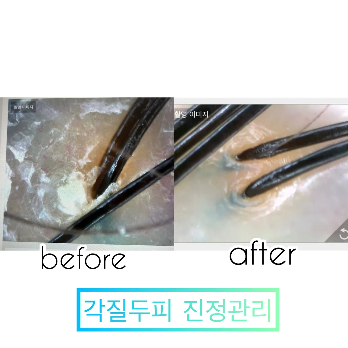 이미지 9