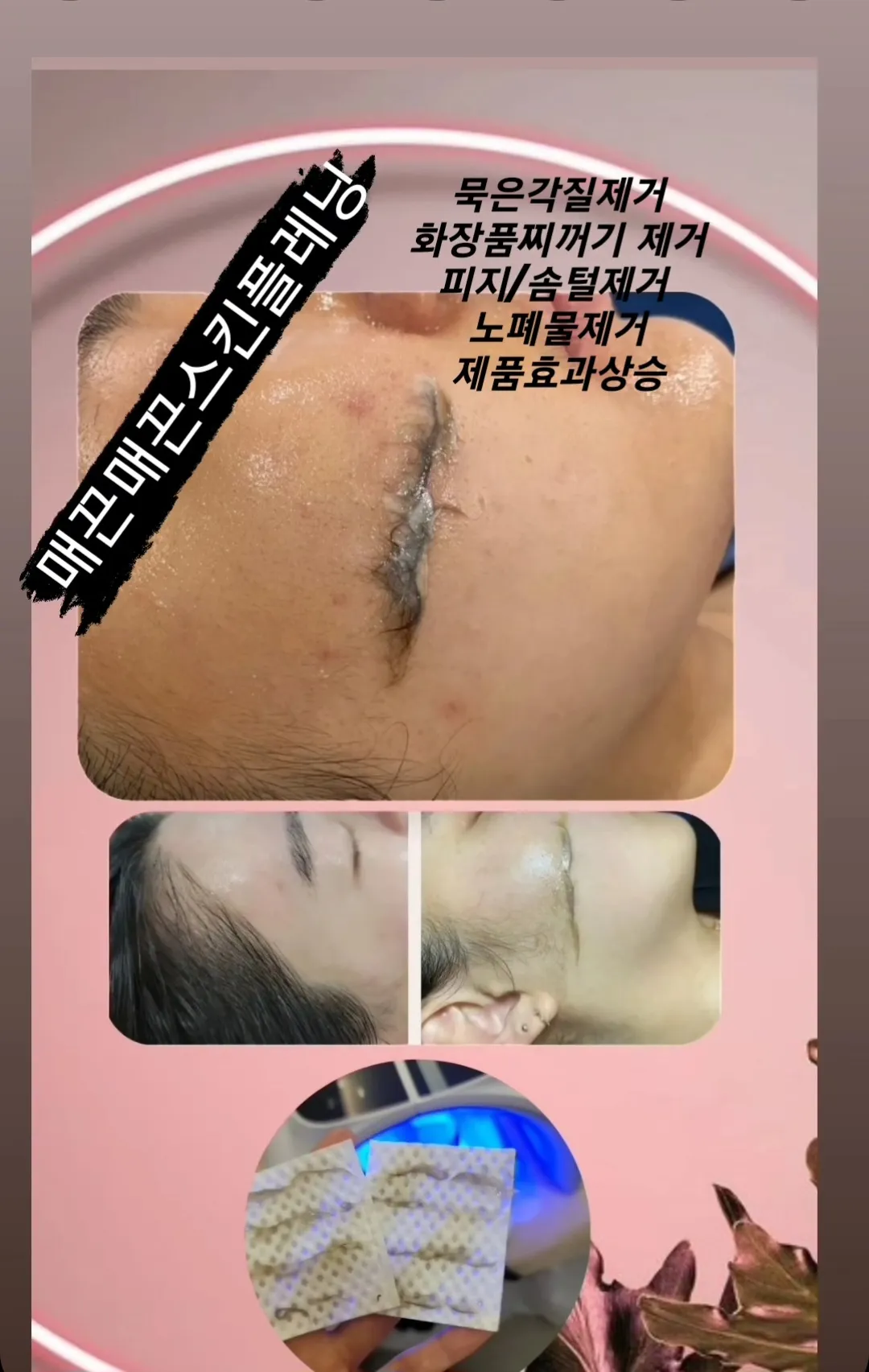 이미지 5