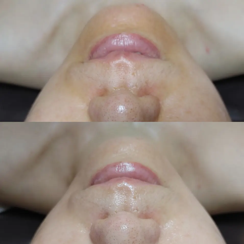 이미지 4