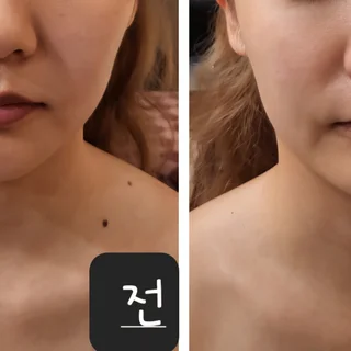 얼굴 경락으로 완성하는 입체적인 윤곽과 빛나는 피부