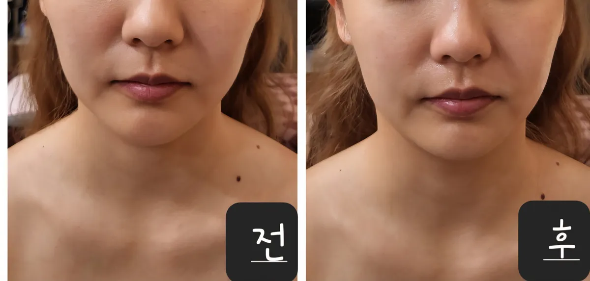 이미지 5