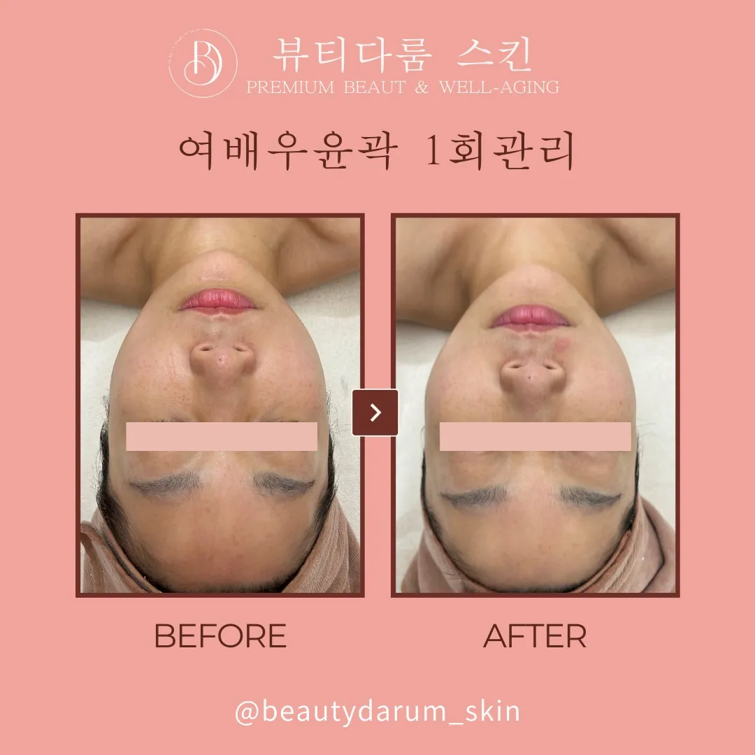 이미지 8