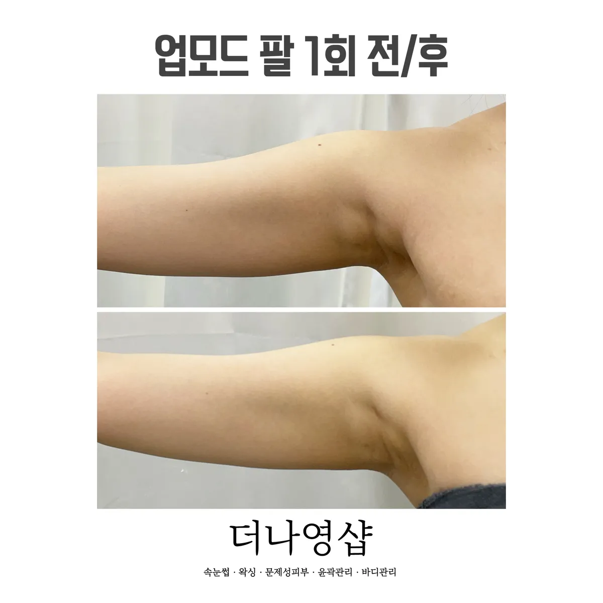 이미지 11