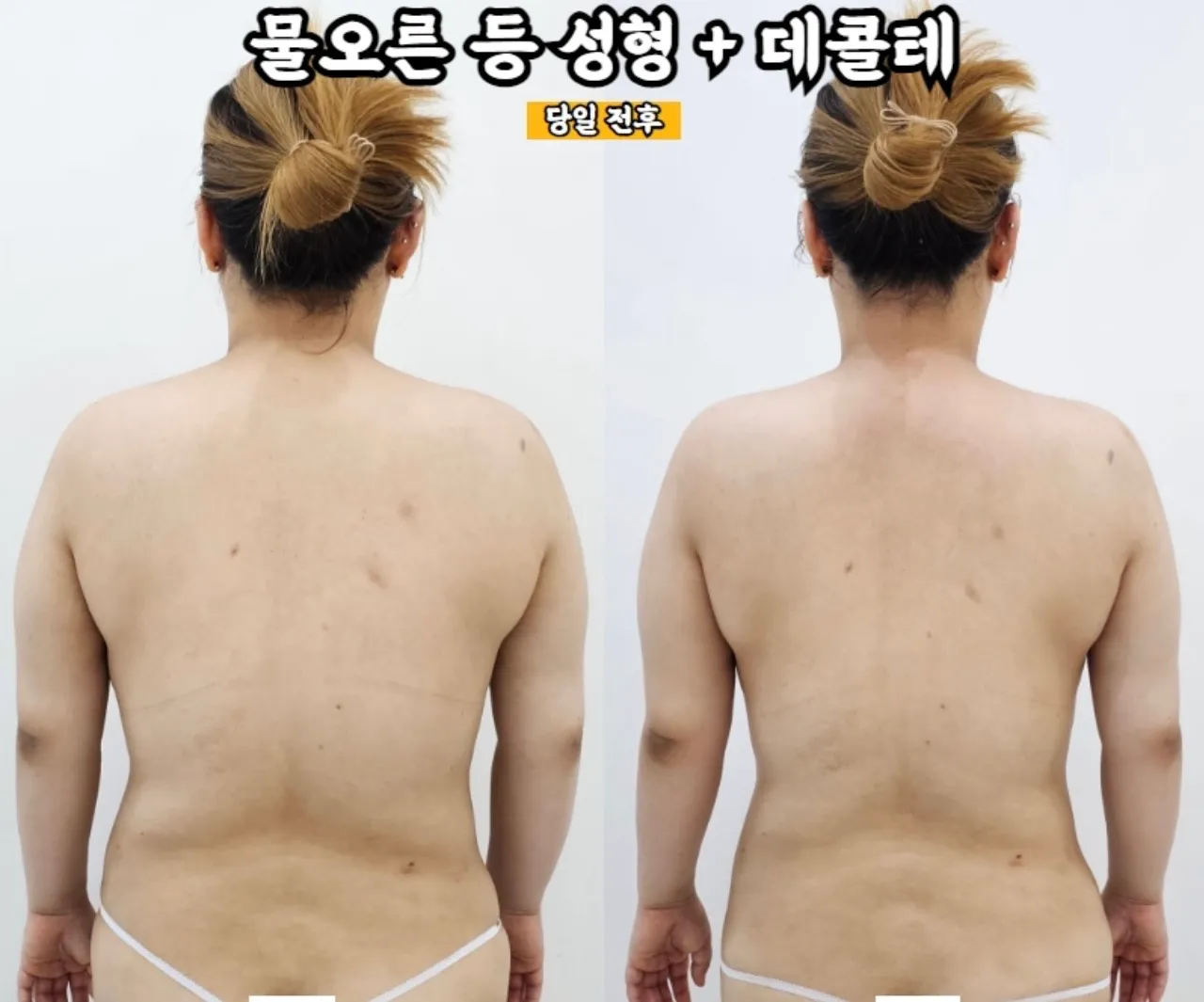 이미지 6
