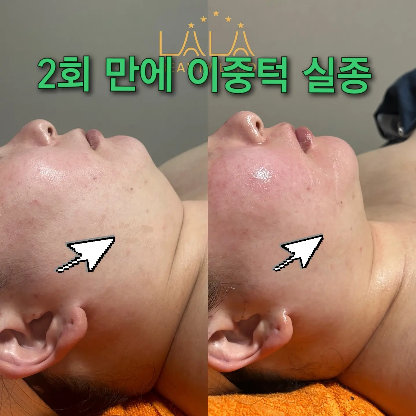 이미지 4
