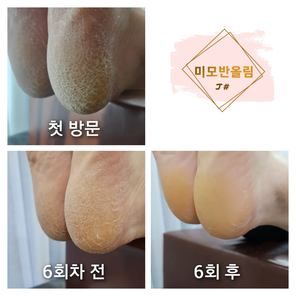 이미지 3