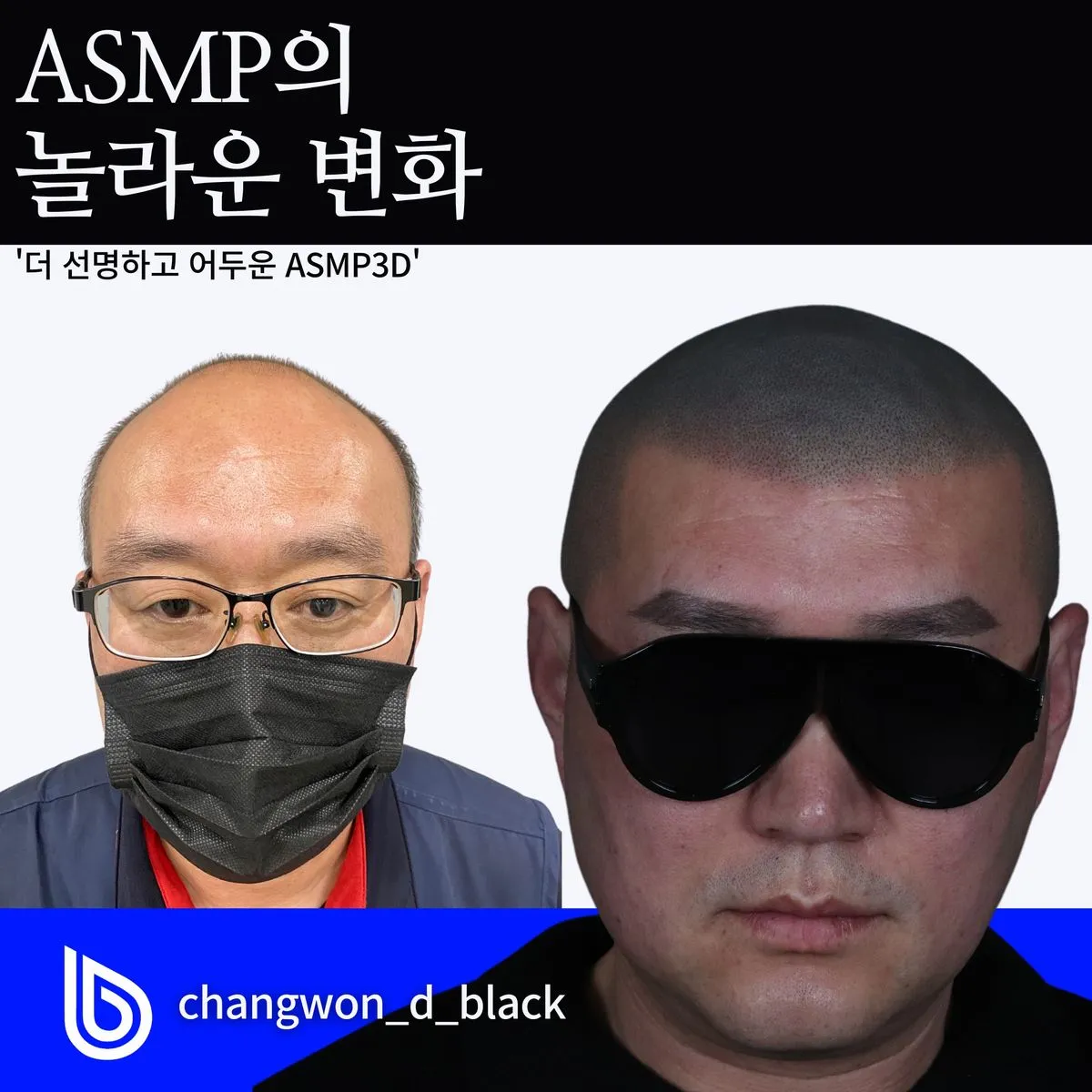 탈모 더 이상 남의 일이 아닙니다 / 디블랙창원 - 숨고, 숨은고수 탈모 더 이상 남의 일이 아닙니다
