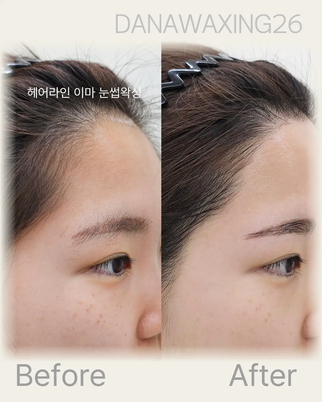 이미지 6