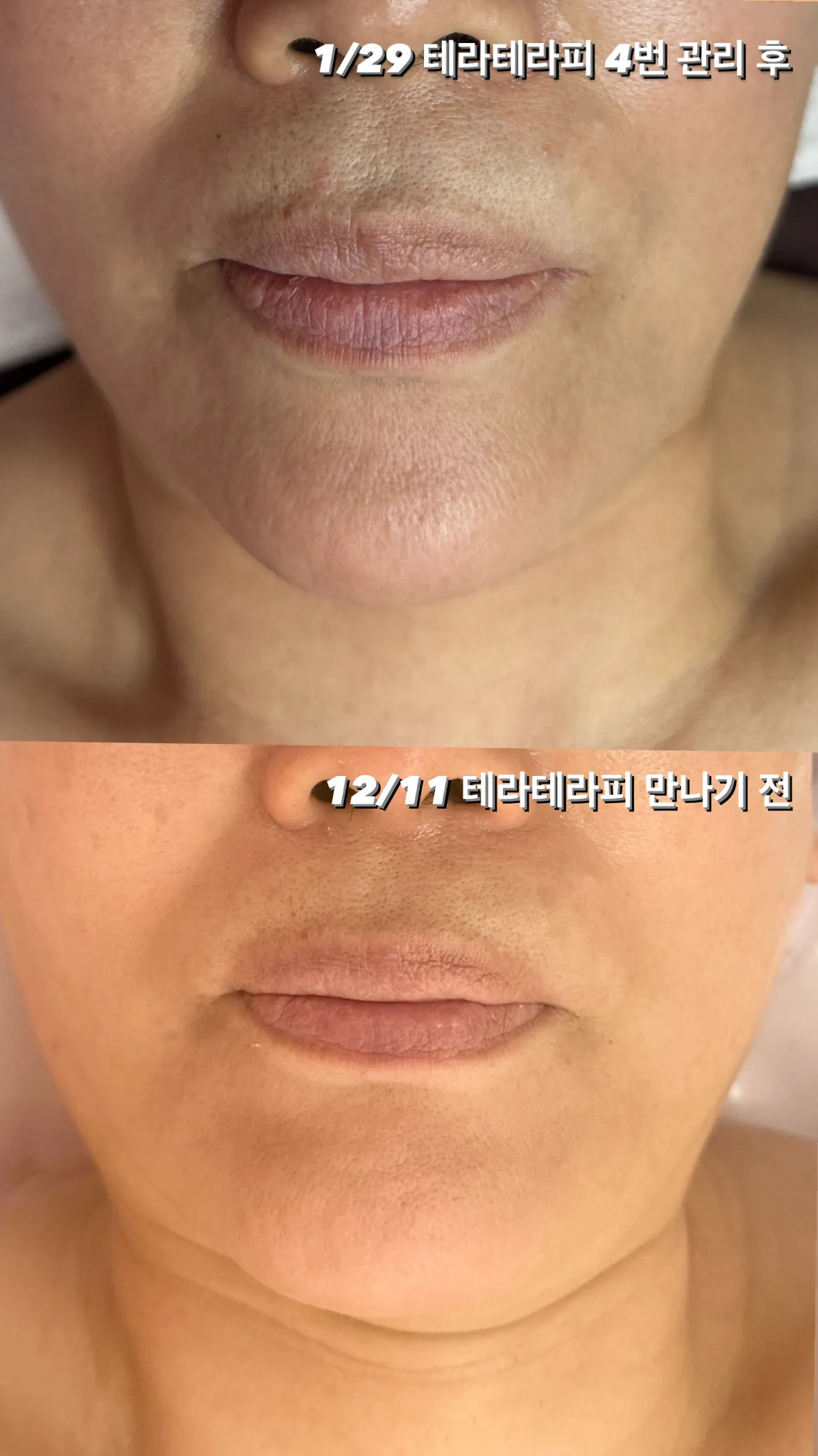 이미지 5
