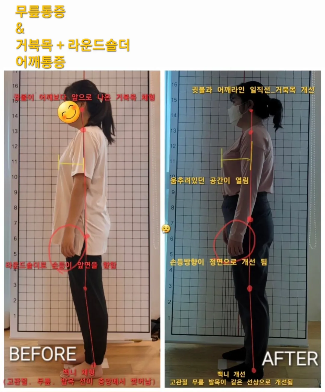 이미지 6