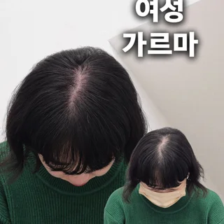 여성 가르마 정수리 커버 2회차 (2/3)