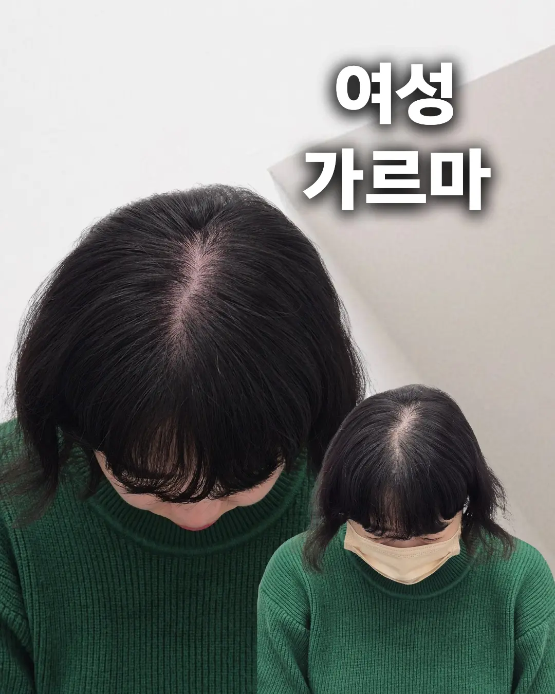 이미지 3