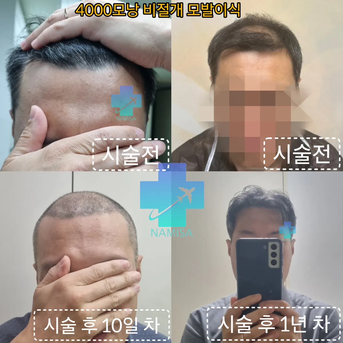 이미지 20