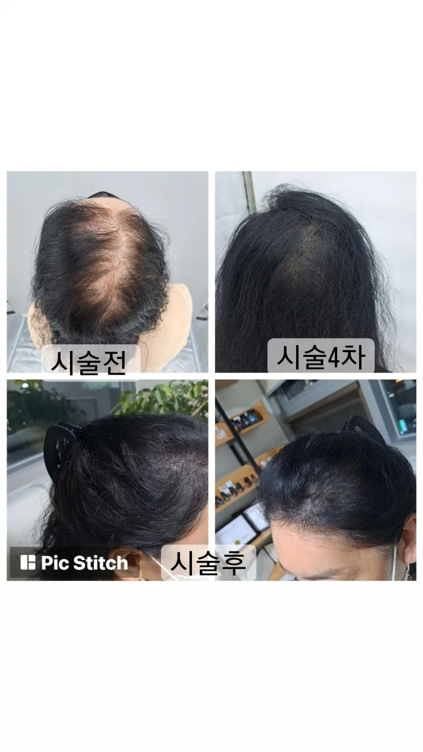 이미지 4
