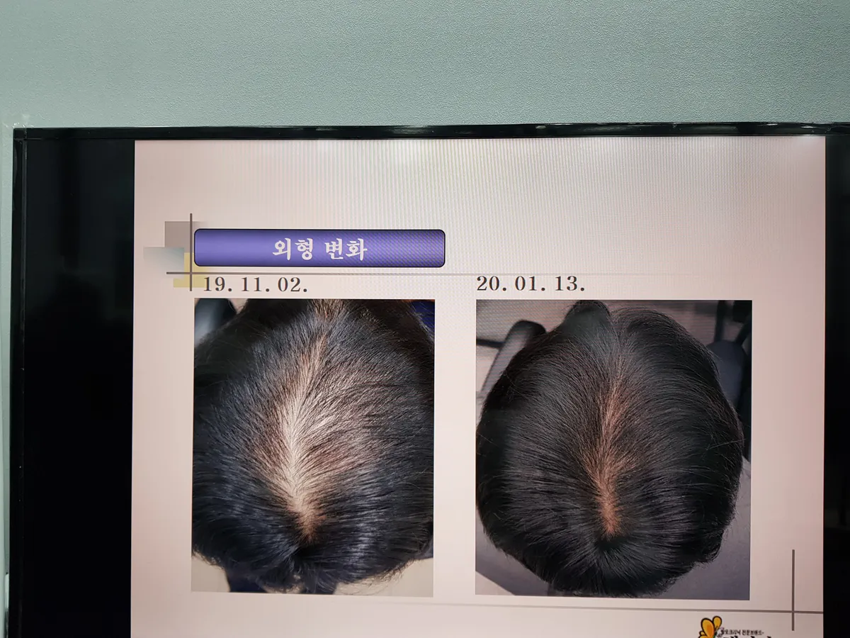 이미지 5
