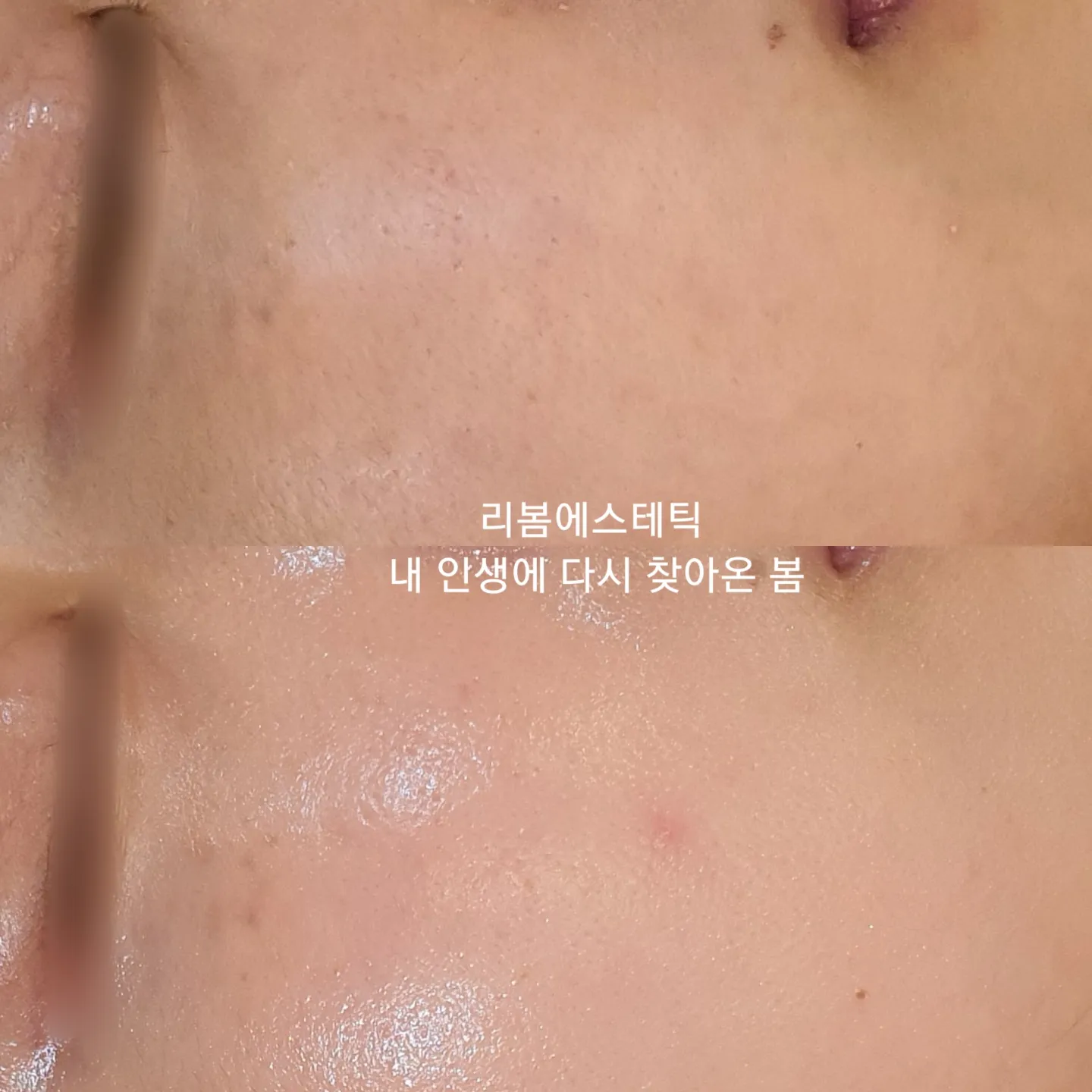 이미지 5