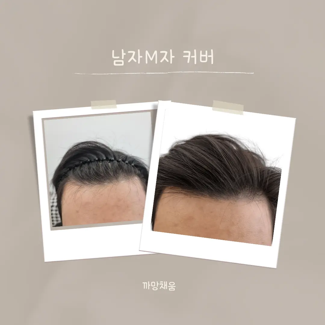 이미지 3
