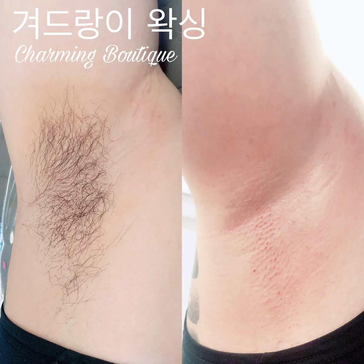 이미지 5