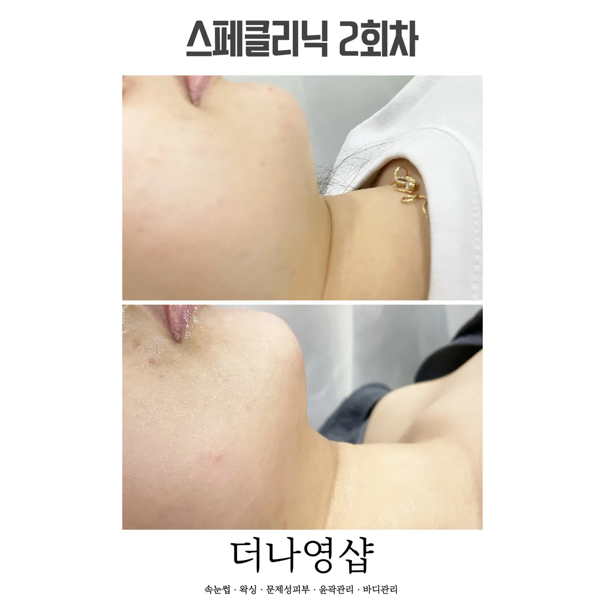 이미지 9