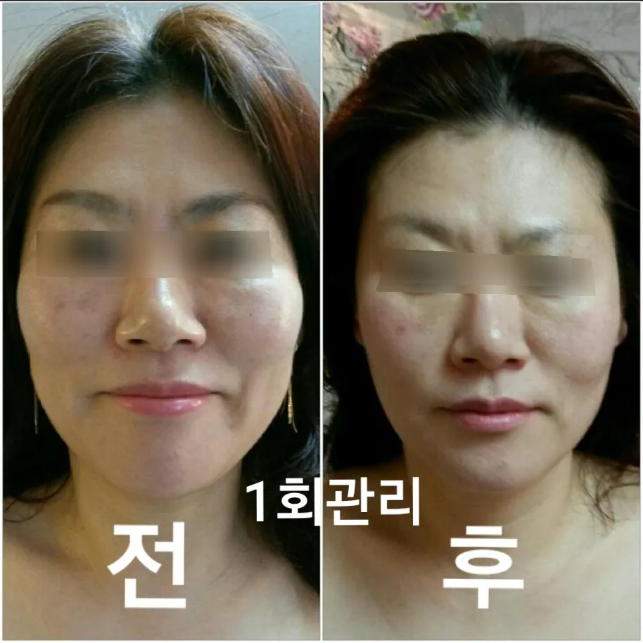 이미지 8