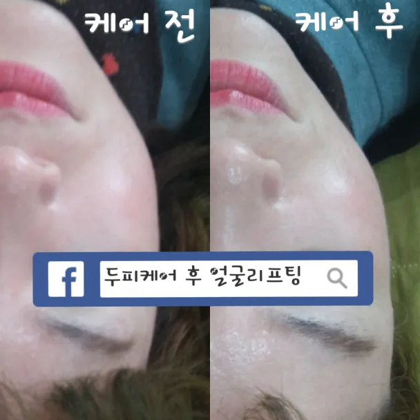 이미지 4