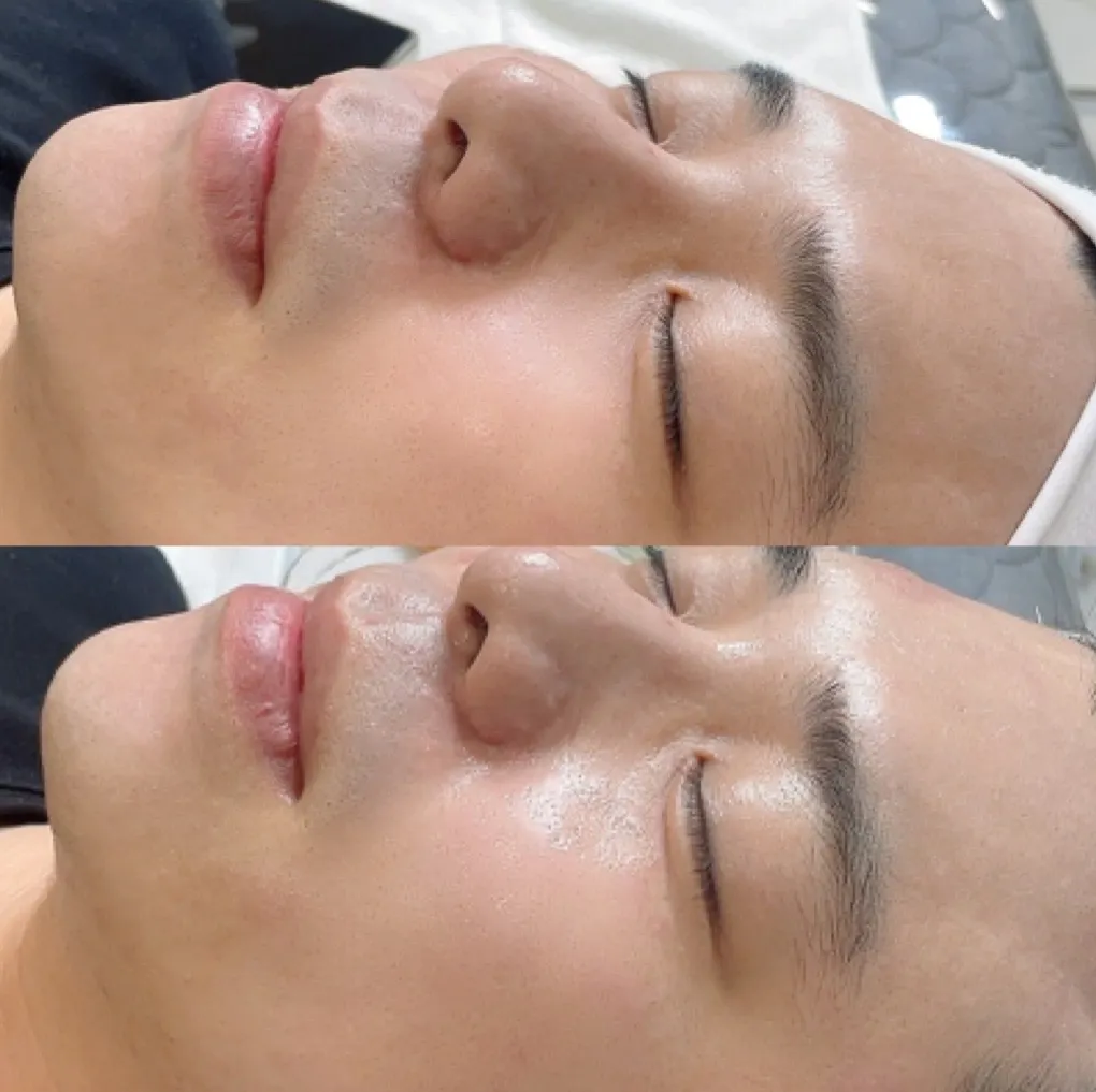 이미지 5