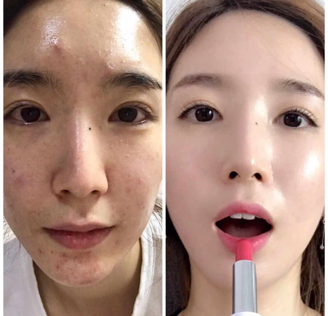 이미지 3