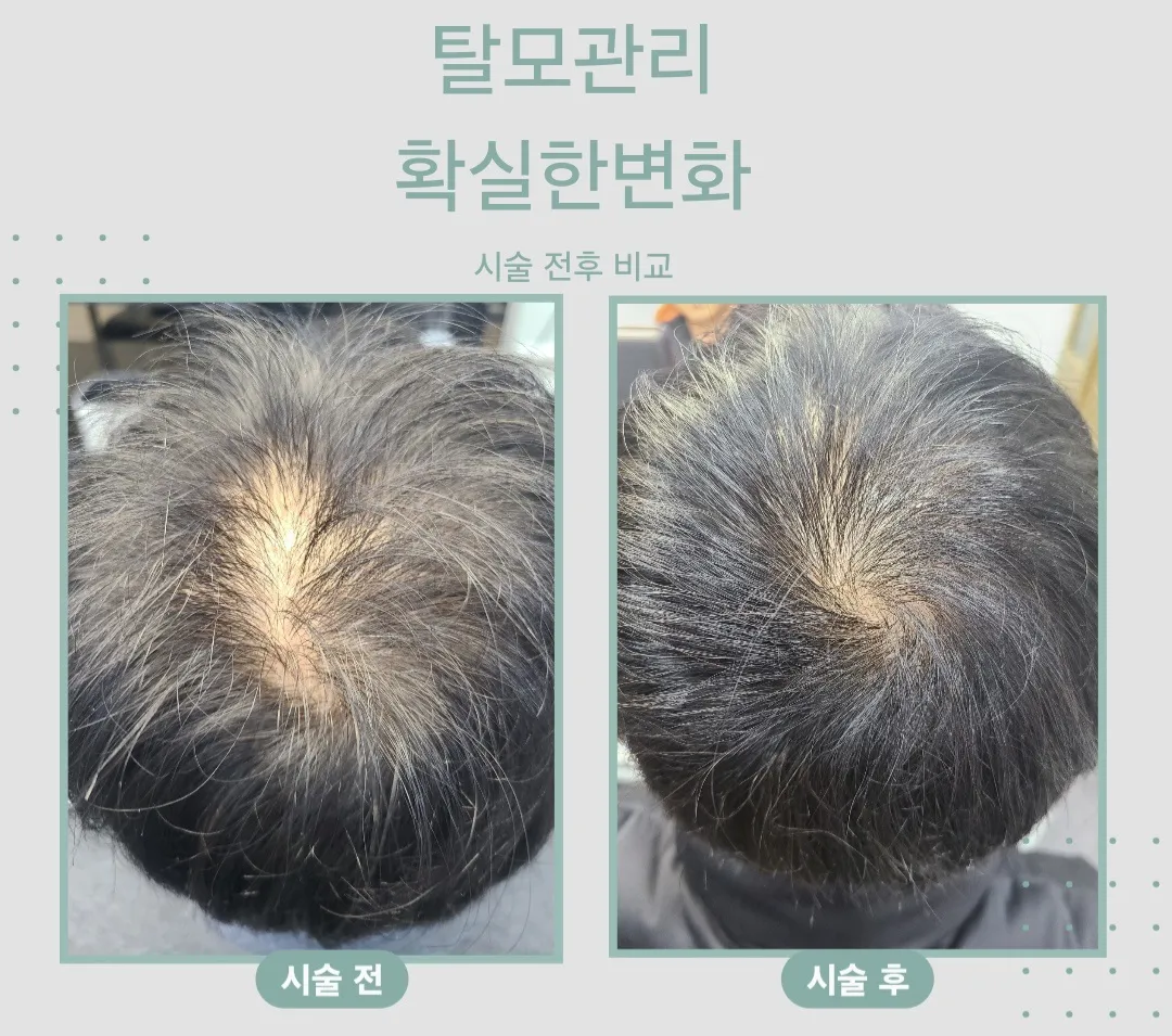 이미지 8
